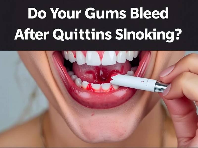 Do Your Gums Bleed After Quitting Smoking? Find Out Why and What to Do