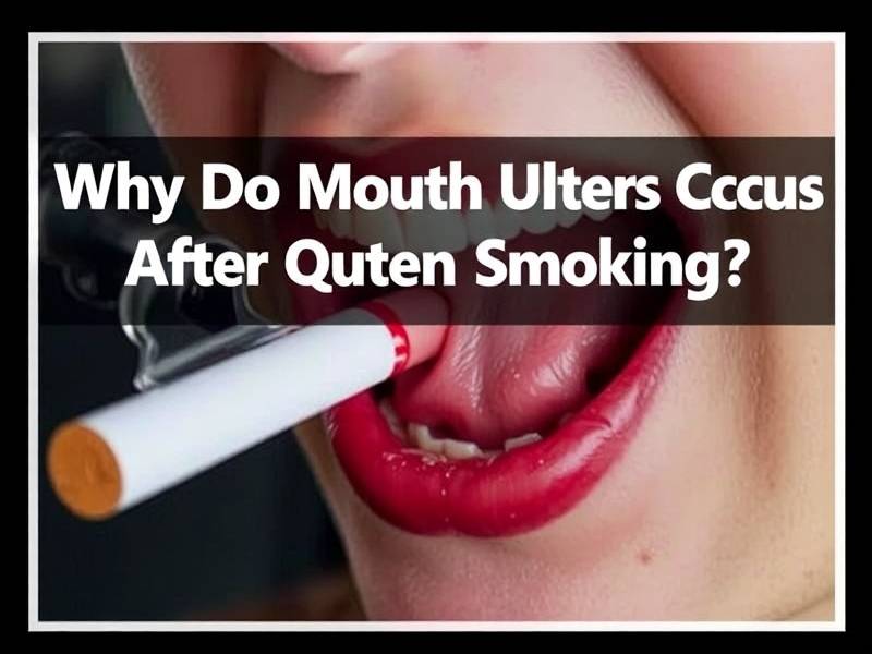 Why Do Mouth Ulcers Occur After Quitting Smoking?