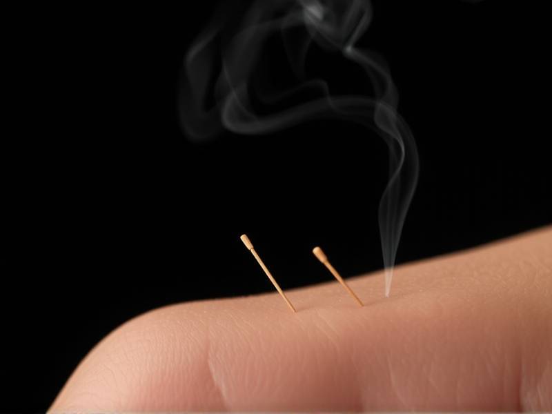 Where Can I Find Acupuncture for Quitting Smoking?