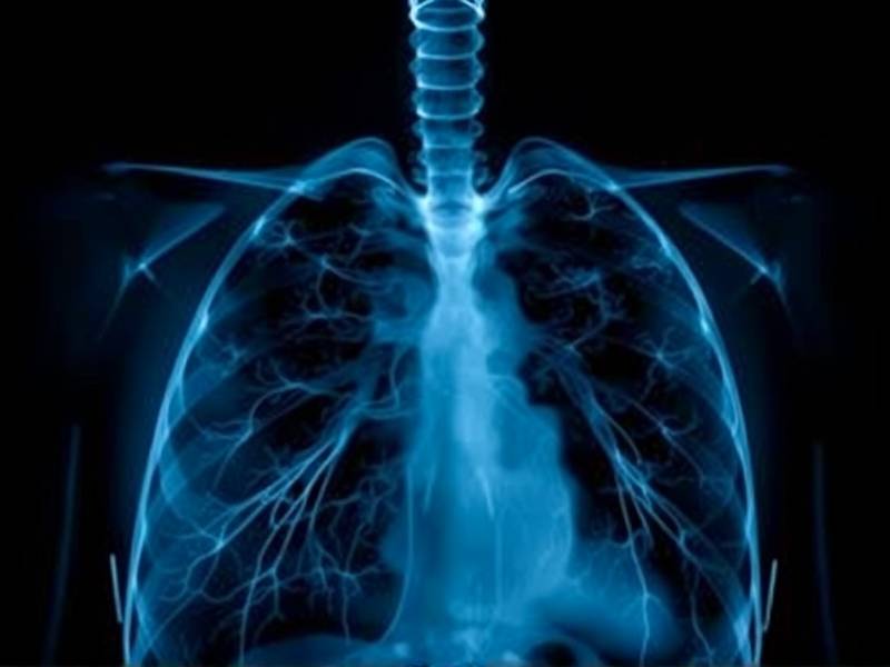 Does Quitting Smoking Really Stop the Progression of Emphysema?