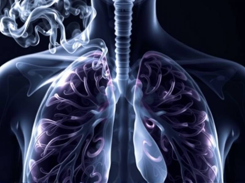 How Long Does It Take for Your Lungs to Clean Up After Quitting Smoking?