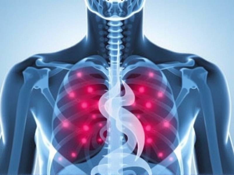 Does Quitting Smoking Really Cause Bronchitis? The Science Behind the Question