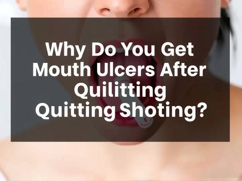 Why Do You Get Mouth Ulcers After Quitting Smoking?