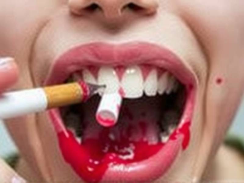 How Long Do Gums Bleed After Quitting Smoking? The Truth You Need to Know(1)