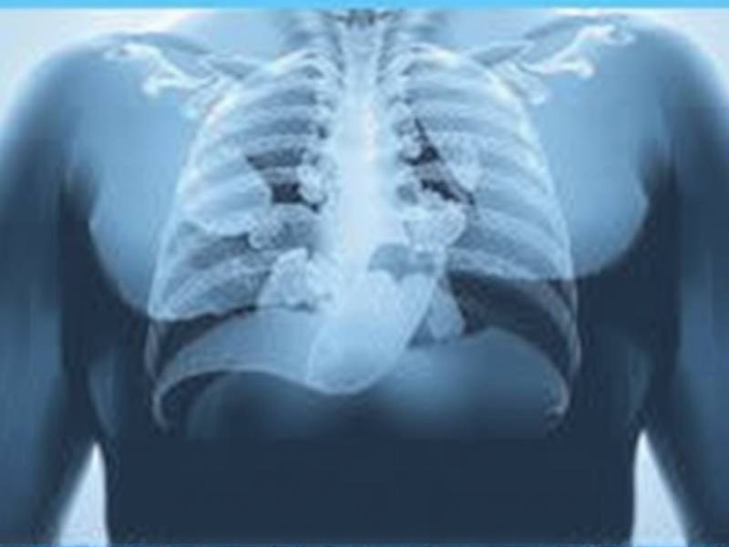 Do You Cough Up Pebbles of Phlegm When You Quit Smoking? The Truth About Lung Health After Quitting Tobacco