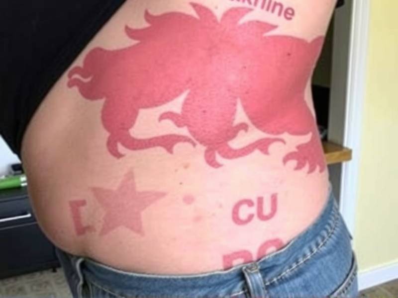 How Long Until Edema Subsides After Quitting Smoking?(1)