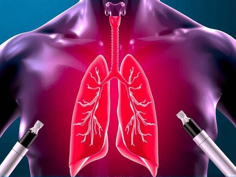 Why Do Lungs Hurt When You Quit Smoking?