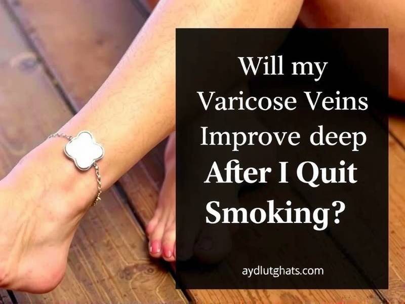 Will My Varicose Veins Improve After I Quit Smoking?(1)